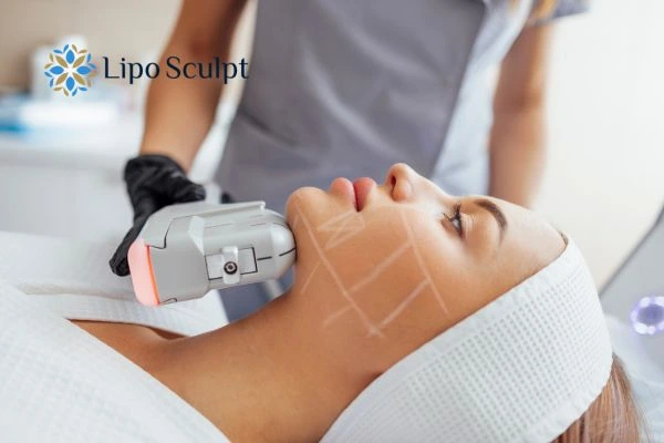 HIFU vs Botulinum Toxin: Understanding the Differences 1 HIFU vs Botox Glasgow What is the best option for you?