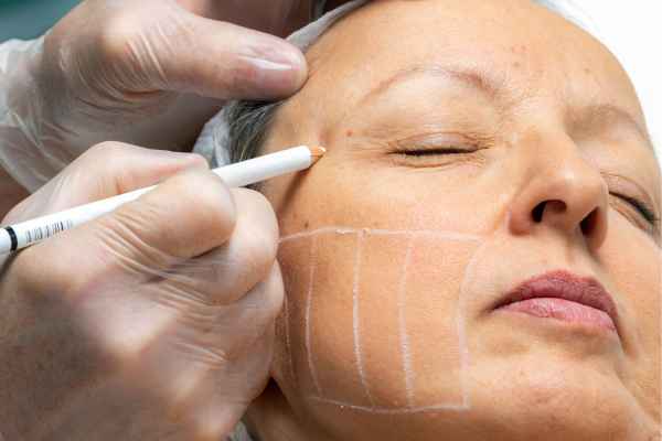 CryoPen: 5 Skin Concerns It May Be Used to Treat 4 What should you ask before having CryoPen treatment Glasgow?