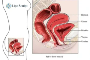 Treatment For A Leaky Bladder 2 How EM Chair treatment Glasgow can help Leaky bladder issues. Read more now!