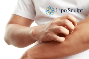 Best Actinic Keratoses Removal 4 prevent your actinic keratoses Glasgow getting worse - call our team today!