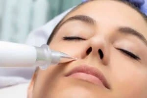 Best Actinic Keratoses Removal 3 Actinic keratoses Glasgow solutions - book in today!