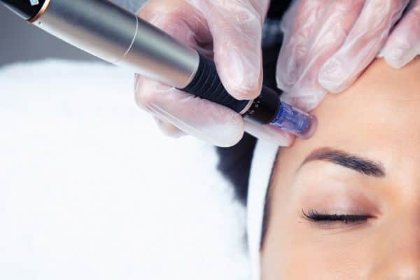 Explaining Total Skin Tightening Treatment and What to Expect 2 What Skin Concerns Can Total Skin Tightening Treatment Help With Glasgow?