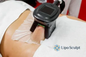 Does Fat Freezing At Home Work? 3 Fat freezing at home from Lipo Sculpt Glasgow